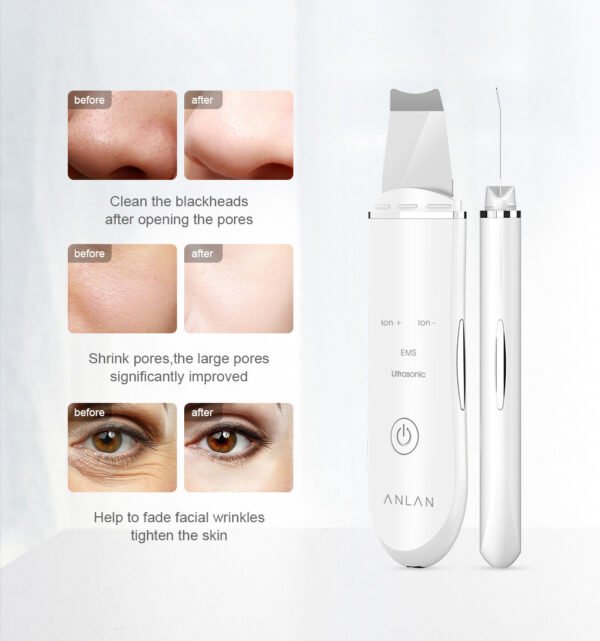 Ultrasonic Skin Scrubber